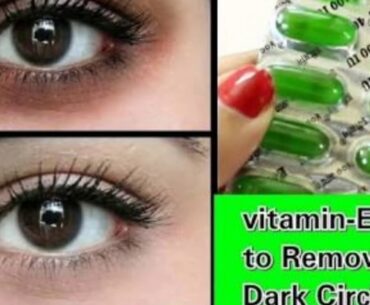 How to remove Dark circles naturally with VITAMIN-E and ALOE VERA (100%) results ( हिन्दी मे)