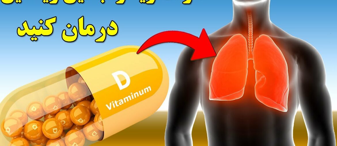 عفونت های ریوی را با ویتامین دی درمان کنید,Treatment of lung infection with vitamin D