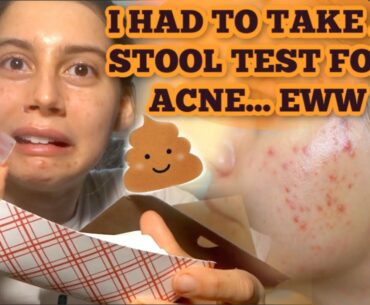 I HAD TO TAKE A STOOL TEST FOR MY ACNE!?!?  MY REACTION, THE PROCESS AND EXPERIENCE....