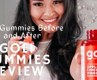 Goli Gummies Review |  Are These Apple Cider Vinegar Gummies Legit to Lose Weight