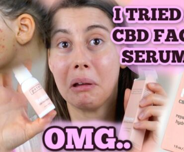 I TRIED A CBD FACE SERUM FOR THE FIRST TIME ON ACNE... OMG. || MY REACTION