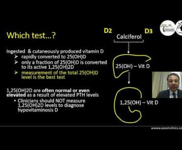 Essentials of Vitamin D and Calcium - Ahmed H Abdelazeem