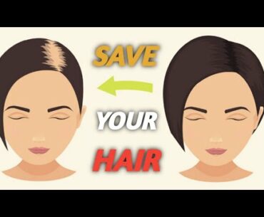 The Shocking Truth About Female Hair Loss Which Will Blow Your Mind - NATURAL CURES