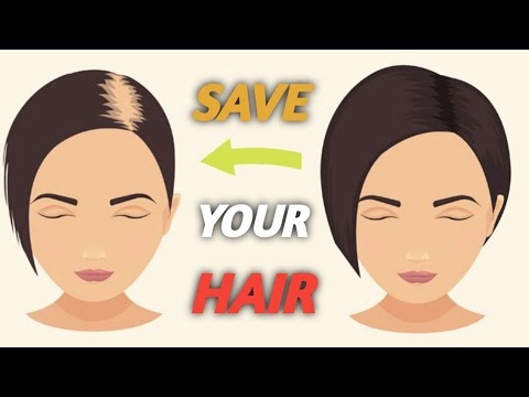 The Shocking Truth About Female Hair Loss Which Will Blow Your Mind - NATURAL CURES