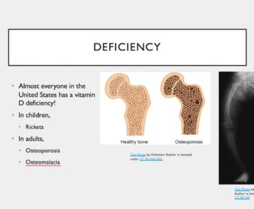 Vitamin D Nutrient Presentation