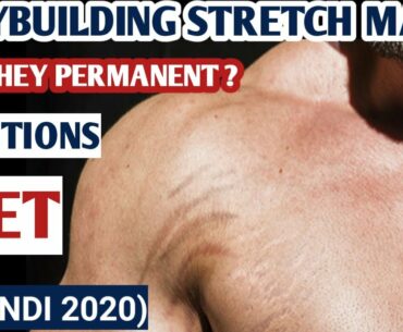 How To Prevent Stretch Marks Due To Muscle Gain | Reduce Stretch Marks In 2020 By Sckullfitness