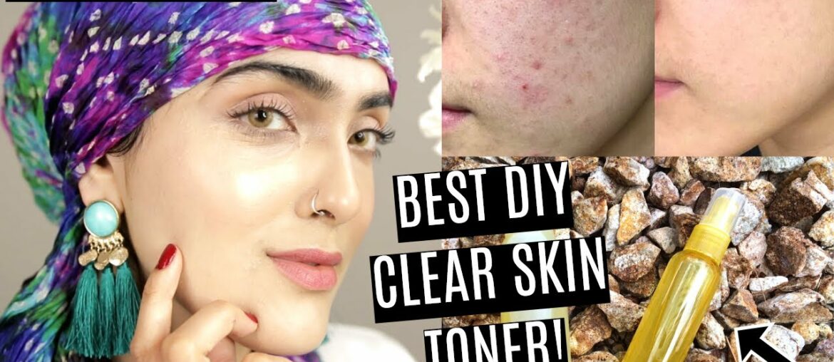 BEST DIY VITAMIN C TONER FOR CLEAR SKIN! (Dry, Normal + Oily Skin Tx) ~ Immy