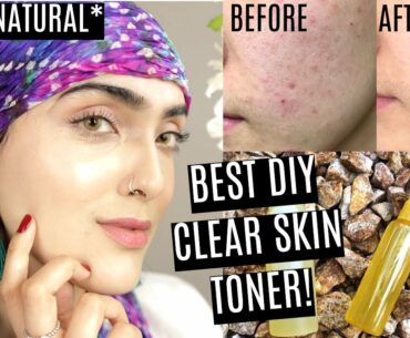 BEST DIY VITAMIN C TONER FOR CLEAR SKIN! (Dry, Normal + Oily Skin Tx) ~ Immy