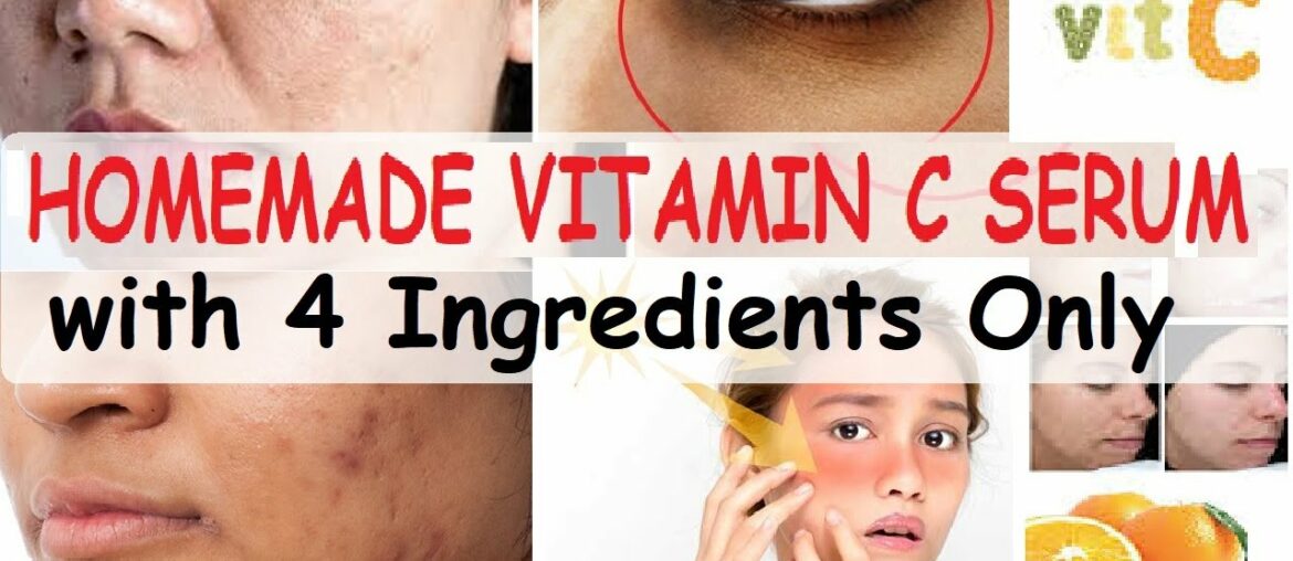 Homemade Vitamin C serum with 4 Ingredients|DIY Vitamin C Glow Serum for Fair, Spotless Skin |