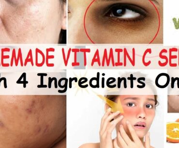 Homemade Vitamin C serum with 4 Ingredients|DIY Vitamin C Glow Serum for Fair, Spotless Skin |