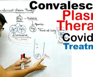 Convalescent plasma therapy | for Covid 19 treatment