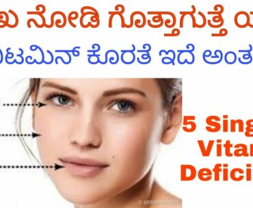 How To Know Vitamin Deficiency | How To Know If You Are Vitamin Deficiency | Vitamin Deficiency