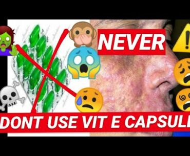 💚VIT E CAPSULE💚 - ⚠️ never ⚠️ | why you should never use the capsules.