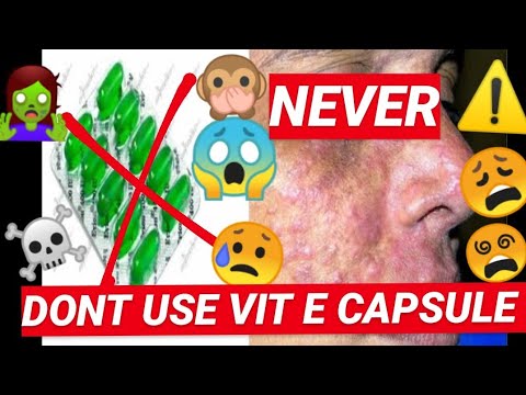 💚VIT E CAPSULE💚 - ⚠️ never ⚠️ | why you should never use the capsules.