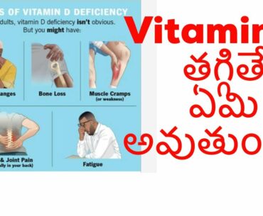 Vitamin-D deficiency/Problems with lack of vitamin-d/ good health/body pains/ weakness/vitamins