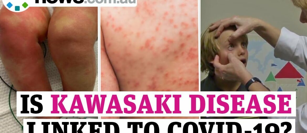 Kawasaki disease: children dead amid fears over link to COVID-19