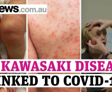 Kawasaki disease: children dead amid fears over link to COVID-19