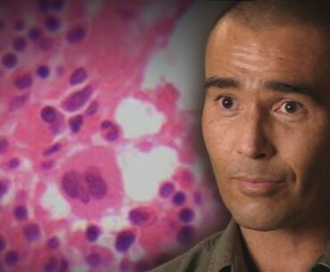 Vitamin C for cancer? ‘Miracle man’ Anton Kuraia's highly controversial treatment