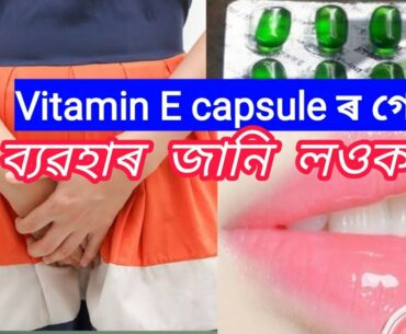 Beauty tips Assamese | daily tips | Assamese health tips | assamese health care | Vitamin E use