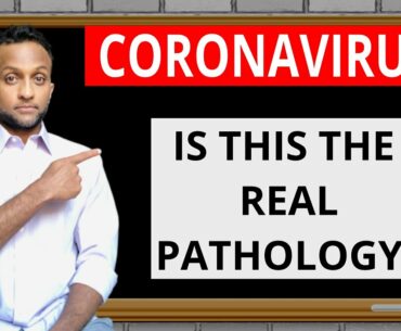 Coronavirus Pathology: Galectin-3, Hemoglobin, Cytokines | Arachidonic Acid Pathway Causing Strokes?