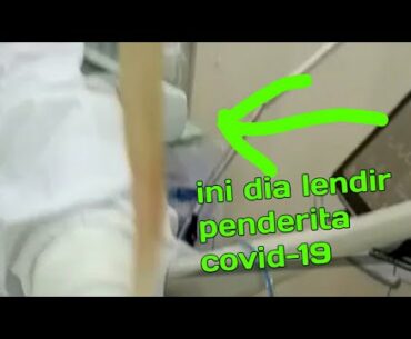 Viral! Ini dia lendir dari penderita covid-19