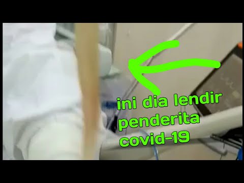 Viral! Ini dia lendir dari penderita covid-19