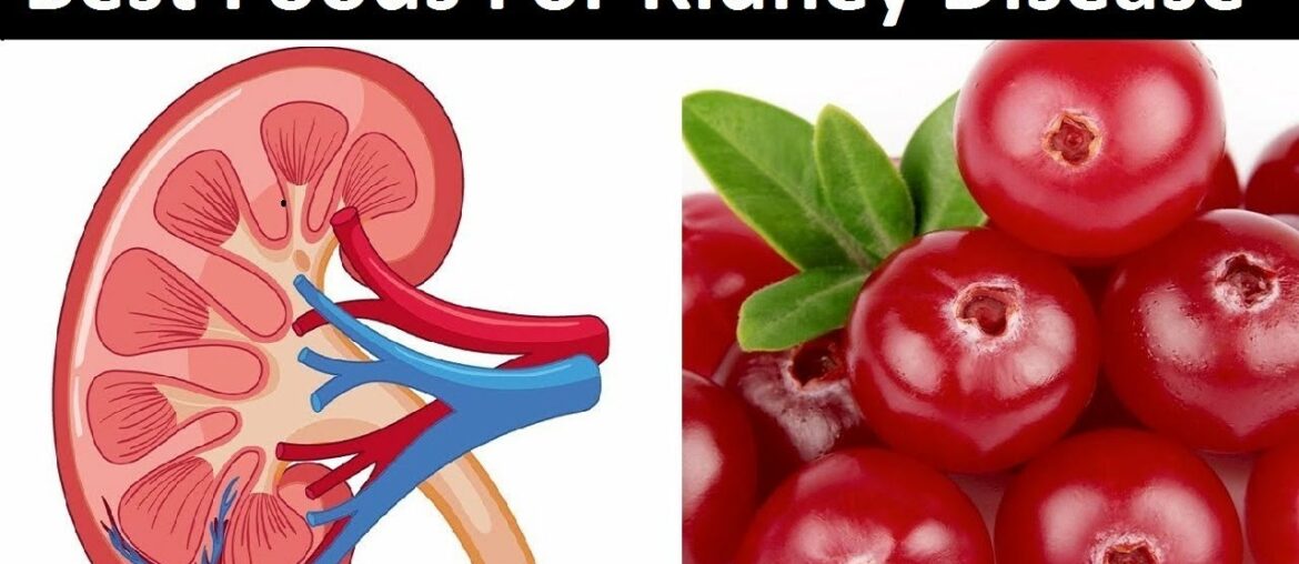 10 Foods That Are Good for Your Kidneys