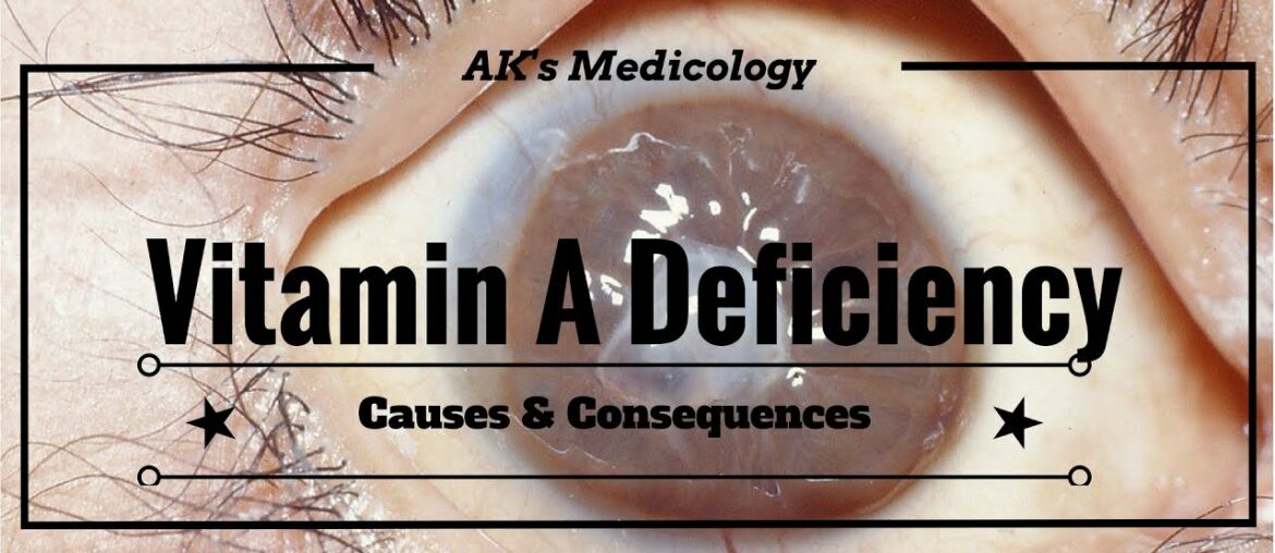 Vitamin A deficiency: Causes & Consequences | Dr. Akshay Kewlani