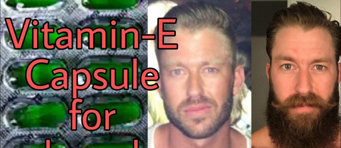 Vitamin e capsule for beard growth | vitamin e capsules for beard growth reviews