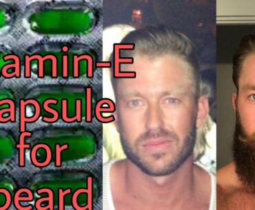 Vitamin e capsule for beard growth | vitamin e capsules for beard growth reviews