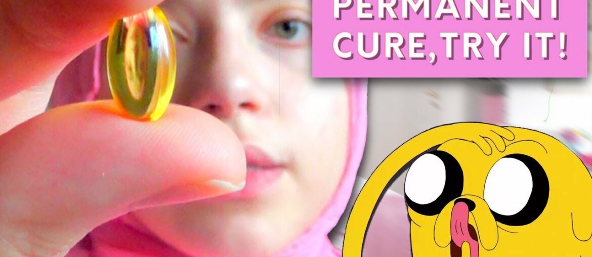 VITAMIN E  TRANSFORMATION TO PERMANENTLY CURE ACNE! | UPDATED | pt.2