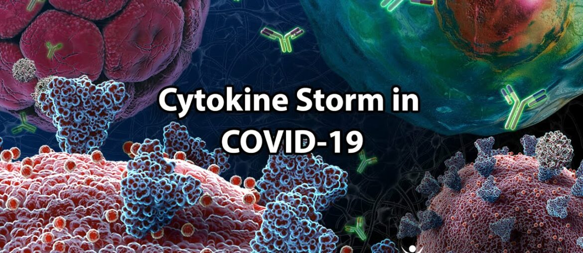 Cytokine Storm in COVID-19
