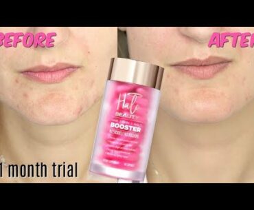 We tried Halo Beauty Vitamins for a month and here are our results. Before & after review