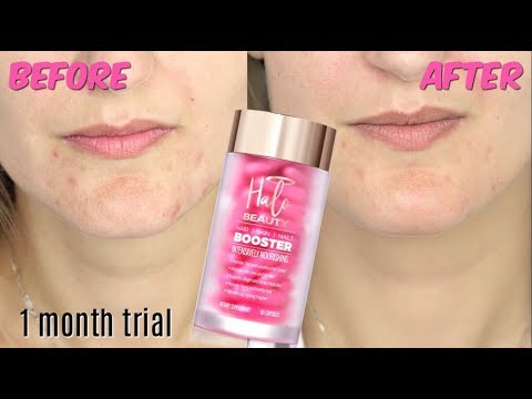 We tried Halo Beauty Vitamins for a month and here are our results. Before & after review