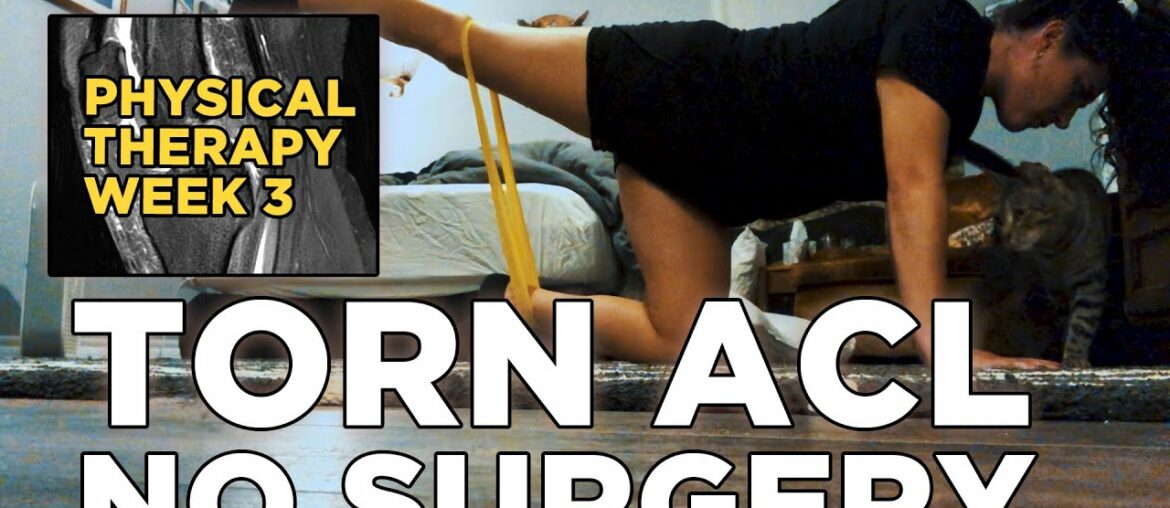 Torn ACL NO SURGERY At Home Workouts/Physical Therapy- Week 3