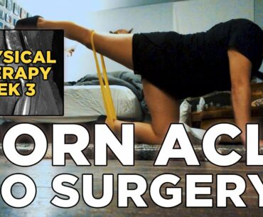 Torn ACL NO SURGERY At Home Workouts/Physical Therapy- Week 3