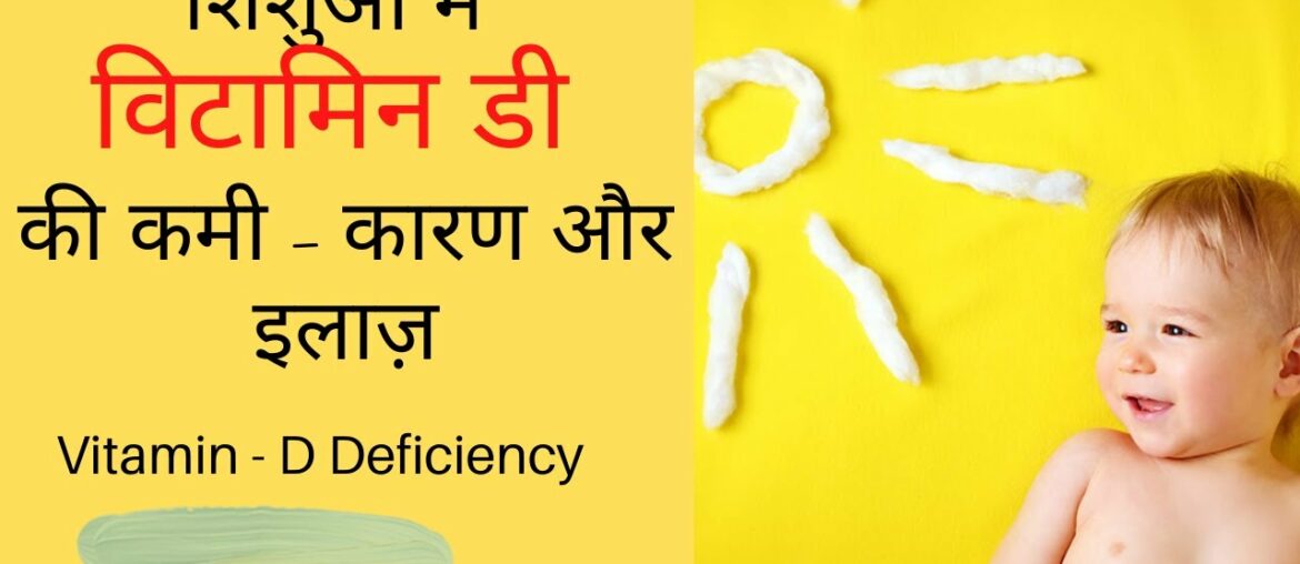 Vitamin D deficiency in Children- Symptoms & Treatment | कैसे करें बच्चों की हड्डिया मजबूत