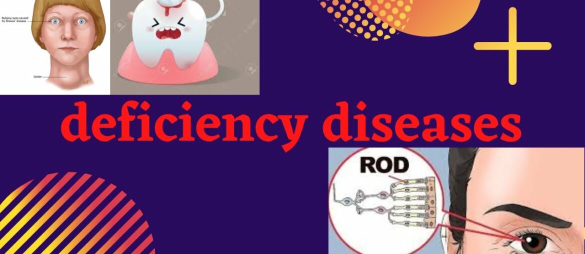 DEFICIENCY DISEASES/COMPONENTS OF FOOD/CHAPTER 2/CLASS 6/SCIENCE/NCERT/GK-Competitive exams