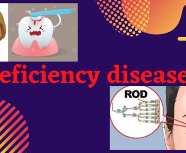 DEFICIENCY DISEASES/COMPONENTS OF FOOD/CHAPTER 2/CLASS 6/SCIENCE/NCERT/GK-Competitive exams