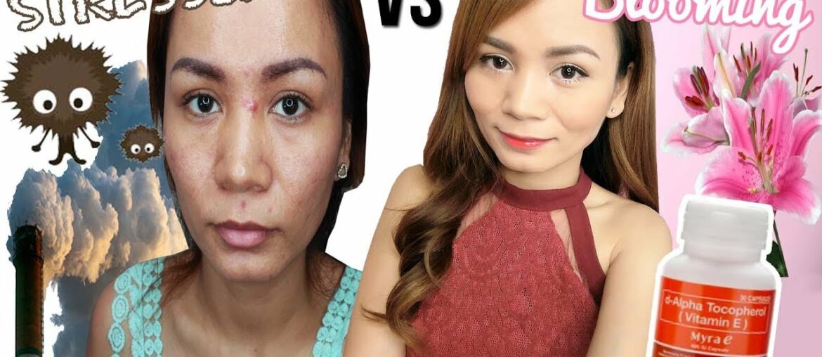 PAANO MAGING MAGANDA?! | MYRA VITAMIN E Benefits Acne-Prone Skin