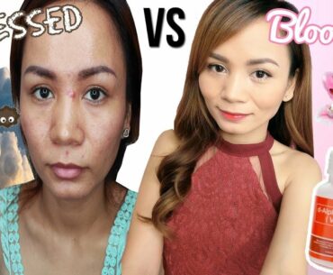 PAANO MAGING MAGANDA?! | MYRA VITAMIN E Benefits Acne-Prone Skin