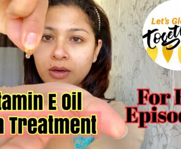 Vitamin E Oil Skin Treatment |Get Beautiful ,Spotless, glowing Skin  ||  Eid Special Ep6