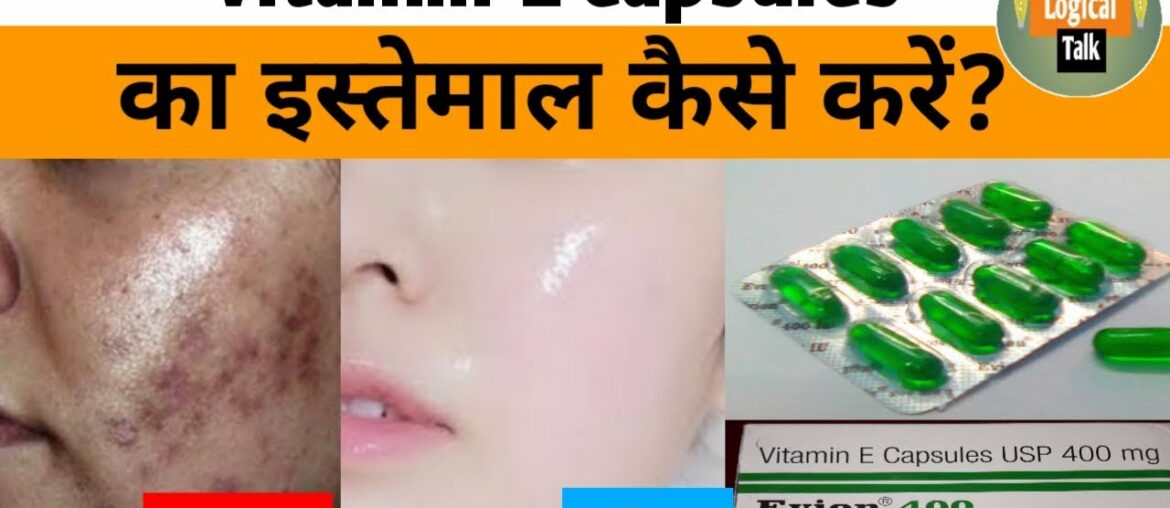 Vitamin E evion capsule get beautiful spotless skin ।benefits use & side effect full review