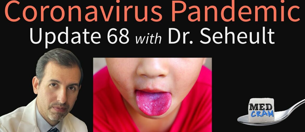 Coronavirus Pandemic Update 68: Kawasaki Disease; Minority Groups & COVID-19