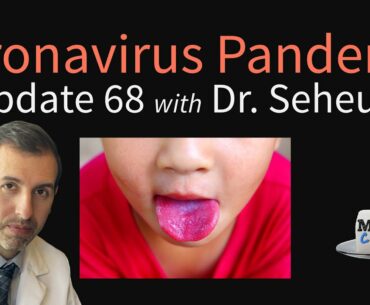 Coronavirus Pandemic Update 68: Kawasaki Disease; Minority Groups & COVID-19