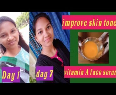 Vitamin A toner/serum for 7days challenge, glass skin, improve skin tone /in telugu