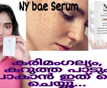 How to Remove Pigmentation malayalam  | NYbae Vitamin c Serum | How to Remove Hyperpigmentation