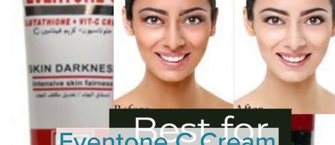 Reality of Best Medicated Skin Whitening Glutathione Vitamin C cream-Eventone C .. Yess or No ?