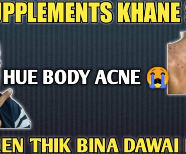 Supplements se hue body acne kaise honge thik | side effects of fake supplements | supplements villa