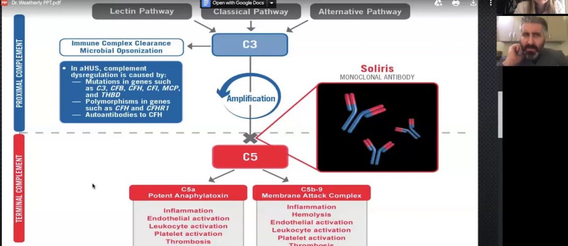 Stroke and Covid-19: Discussion with Neurologist, Dr. Tom Pitts - Part II